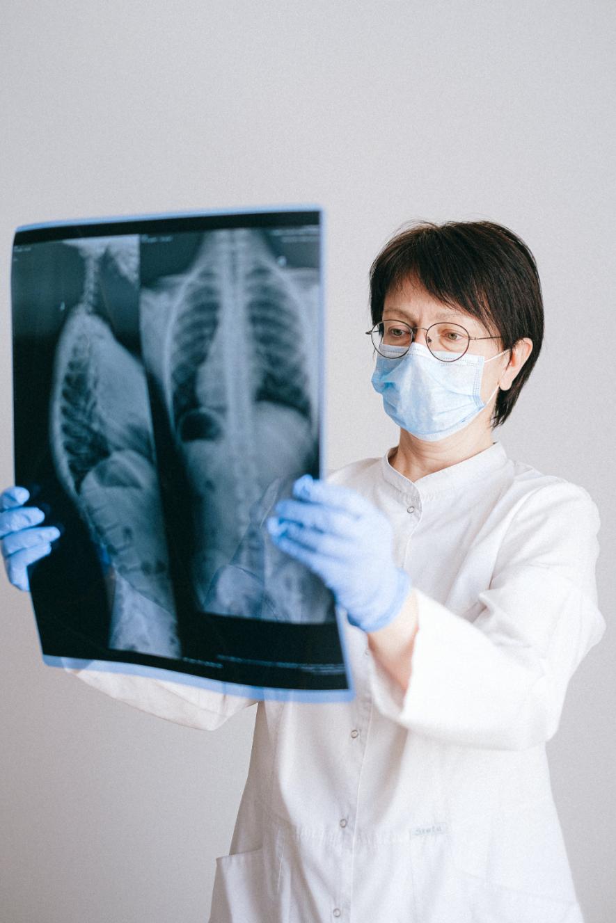 A Female Doctor checking X-Ray of lungs