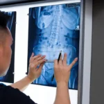 A Chiropractor checking an X-RAY