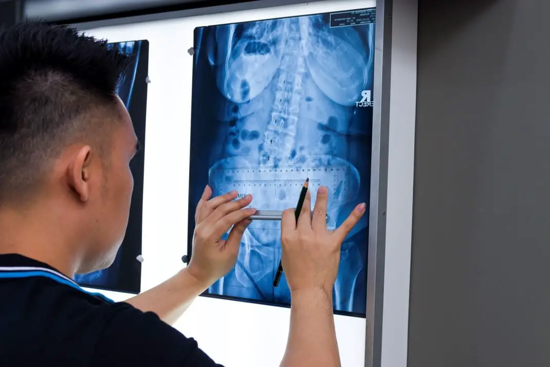 A Chiropractor checking an X-RAY