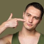 A young man pointing towards his face showing the acne