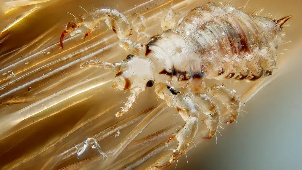 A microscopic view of a parasite.